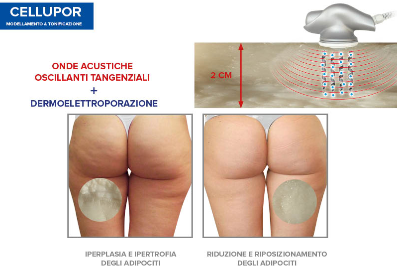 massaggio per cellulite